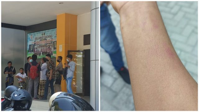 Jurnalis Inside Lombok Diduga Dianiaya Oknum Satpol PP Lotim