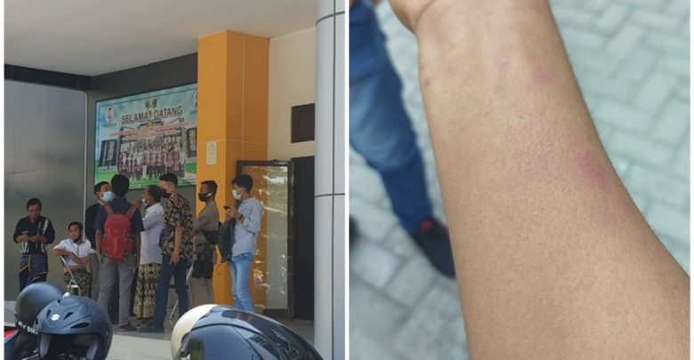 Jurnalis Inside Lombok Diduga Dianiaya Oknum Satpol PP Lotim